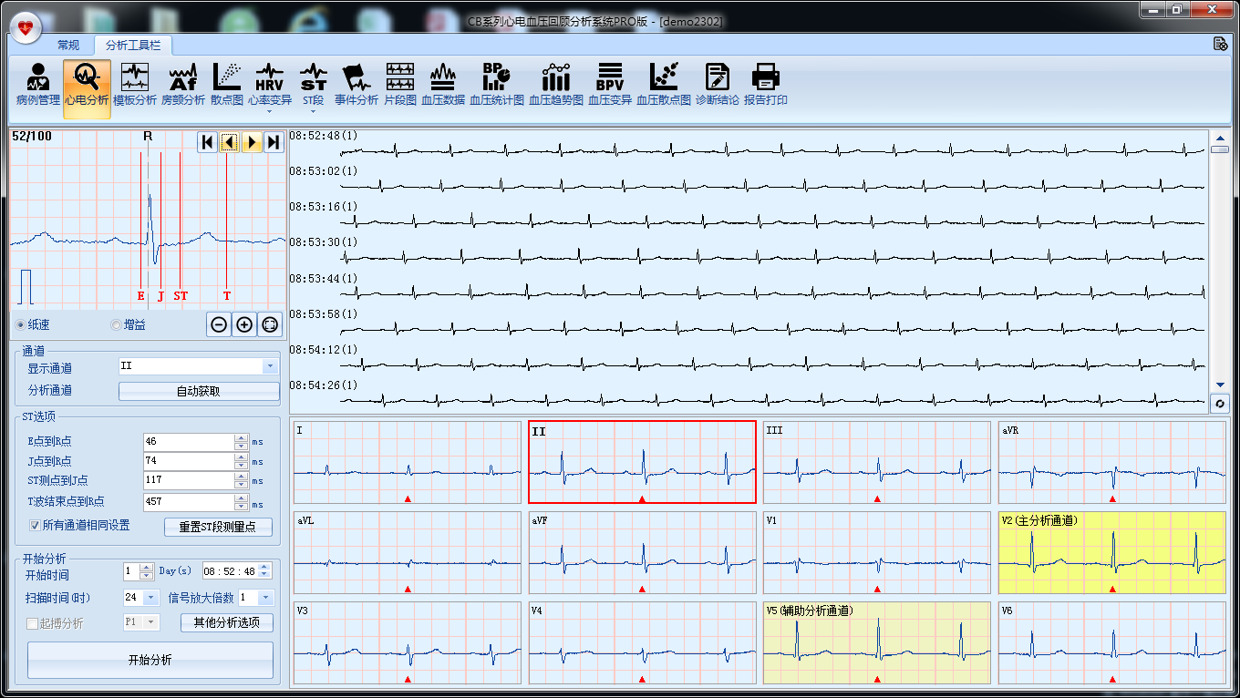 ECG Analysis System V9.1.1