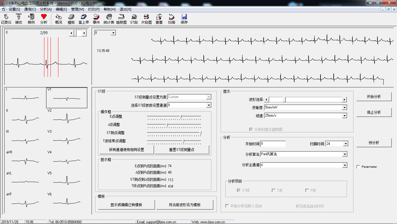 ECG Analysis System V6.1.9